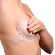 Estetik amaçlı planlanan meme ameliyatları öncesinde ne yapılmalı